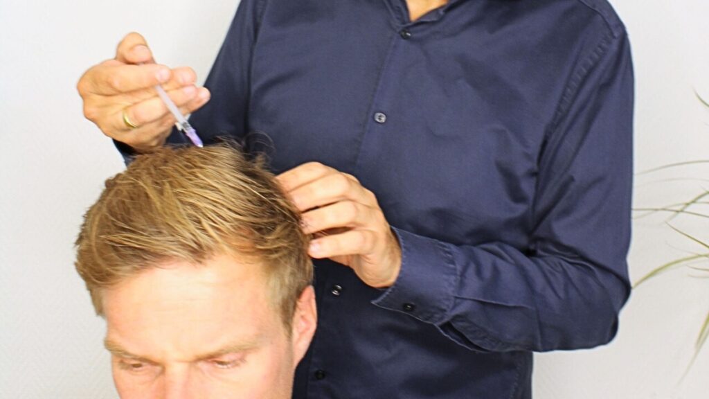 MesoHair: Behandlung am Haaransatz